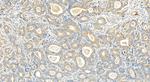RPS11 Antibody in Immunohistochemistry (Paraffin) (IHC (P))