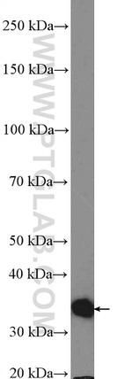 CAPZA2 Antibody in Western Blot (WB)