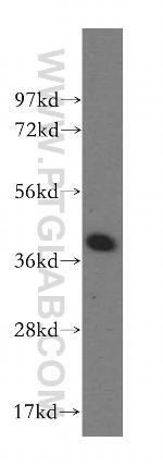 DYNC2LI1 Antibody in Western Blot (WB)