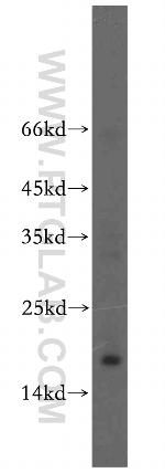 UTP23 Antibody in Western Blot (WB)