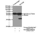 MAT2B Antibody in Immunoprecipitation (IP)