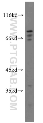 MAT2B Antibody in Western Blot (WB)