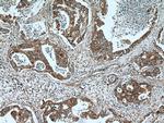 UBR4 Antibody in Immunohistochemistry (Paraffin) (IHC (P))