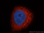 ERp57/ERp60 Antibody in Immunocytochemistry (ICC/IF)