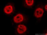 FIBP Antibody in Immunocytochemistry (ICC/IF)