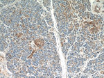 FIBP Antibody in Immunohistochemistry (Paraffin) (IHC (P))