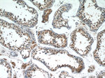 FIBP Antibody in Immunohistochemistry (Paraffin) (IHC (P))