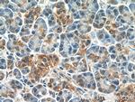 FIBP Antibody in Immunohistochemistry (Paraffin) (IHC (P))