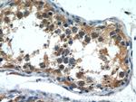 FIBP Antibody in Immunohistochemistry (Paraffin) (IHC (P))