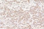 FIBP Antibody in Immunohistochemistry (Paraffin) (IHC (P))