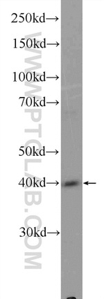 FIBP Antibody in Western Blot (WB)