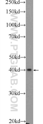 FIBP Antibody in Western Blot (WB)