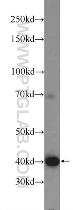 FIBP Antibody in Western Blot (WB)