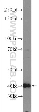 FIBP Antibody in Western Blot (WB)