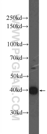 FIBP Antibody in Western Blot (WB)