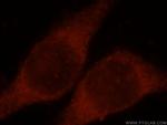 CLIC3 Antibody in Immunocytochemistry (ICC/IF)