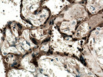 CLIC3 Antibody in Immunohistochemistry (Paraffin) (IHC (P))
