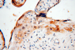CLIC3 Antibody in Immunohistochemistry (Paraffin) (IHC (P))