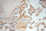 CLIC3 Antibody in Immunohistochemistry (Paraffin) (IHC (P))