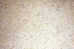 ACOT7 Antibody in Immunohistochemistry (Paraffin) (IHC (P))