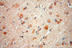ACOT7 Antibody in Immunohistochemistry (Paraffin) (IHC (P))