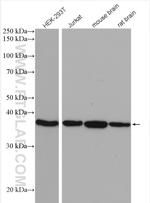 ACOT7 Antibody in Western Blot (WB)