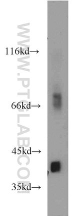 ACOT7 Antibody in Western Blot (WB)