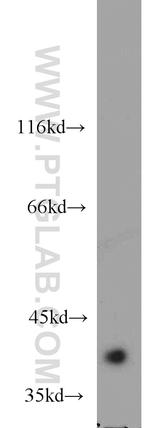 ACOT7 Antibody in Western Blot (WB)