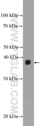 EBP2 Antibody in Western Blot (WB)