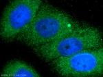 TELO2 Antibody in Immunocytochemistry (ICC/IF)