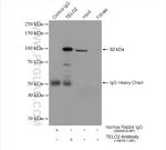 TELO2 Antibody in Immunoprecipitation (IP)