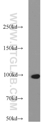 TELO2 Antibody in Western Blot (WB)