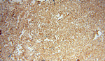 PSMB10 Antibody in Immunohistochemistry (Paraffin) (IHC (P))