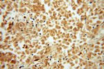 PSMB10 Antibody in Immunohistochemistry (Paraffin) (IHC (P))