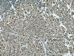 PSMB10 Antibody in Immunohistochemistry (Paraffin) (IHC (P))