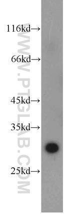 PSMB10 Antibody in Western Blot (WB)
