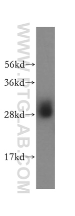 PSMB10 Antibody in Western Blot (WB)