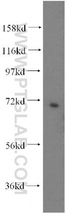 PAPSS2 Antibody in Western Blot (WB)