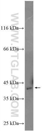 Spermine synthase Antibody in Western Blot (WB)