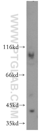 Spermine synthase Antibody in Western Blot (WB)