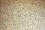 PSMB3 Antibody in Immunohistochemistry (Paraffin) (IHC (P))