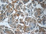 MRPS26 Antibody in Immunohistochemistry (Paraffin) (IHC (P))