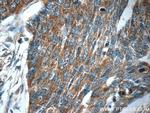 MRPS26 Antibody in Immunohistochemistry (Paraffin) (IHC (P))