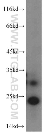 MRPS26 Antibody in Western Blot (WB)