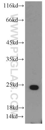 MRPS26 Antibody in Western Blot (WB)