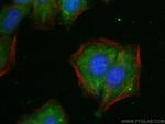 LLGL2 Antibody in Immunocytochemistry (ICC/IF)