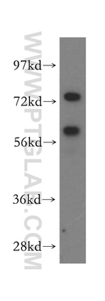 CCT7 Antibody in Western Blot (WB)