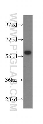 CCT7 Antibody in Western Blot (WB)