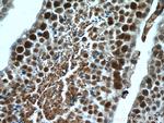 RTCD1 Antibody in Immunohistochemistry (Paraffin) (IHC (P))