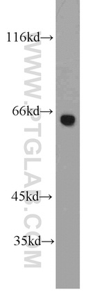 STAU2 Antibody in Western Blot (WB)